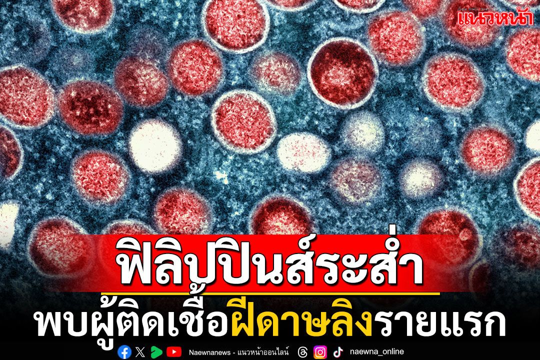 'ฟิลิปปินส์'สะเทือน! พบผู้ติดเชื้อไวรัส'ฝีดาษลิง'รายแรก ไม่มีประวัติเดินทางออกนอกประเทศ