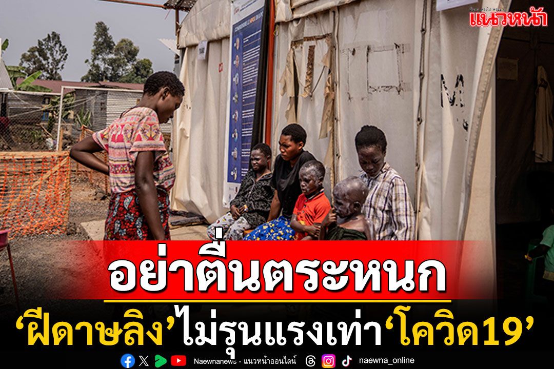 หยุดตื่นตระหนก! 'อนามัยโลก'ชี้ไวรัส'ฝีดาษลิง'ไม่รุนแรงเท่าการระบาดของ'โควิด-19'