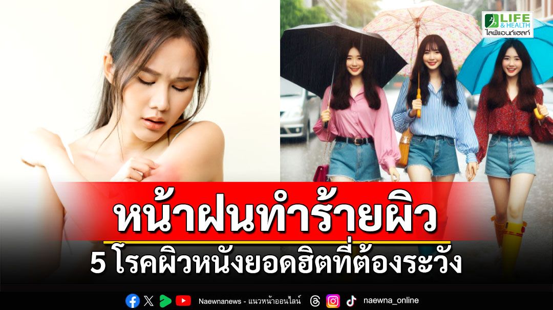 หน้าฝนทำร้ายผิว ส่อง 5 โรคผิวหนังยอดฮิตที่ต้องระวัง