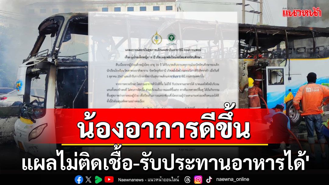 ด.ญ. 14 ปี เหยื่อเพลิงไหม้รถบัส 'อาการดีขึ้น-แผลไม่ติดเชื้อ-รับประทานอาหารได้'