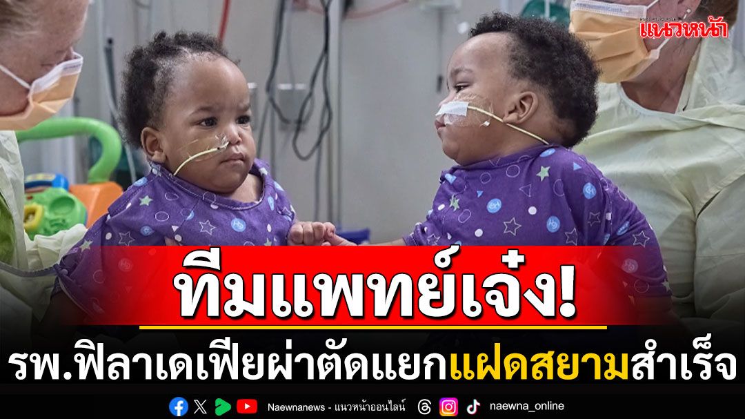 ทีมแพทย์สุดเจ๋ง! รพ.ฟิลาเดเฟียผ่าตัดแยกแฝดสยามสำเร็จ หนูน้อยทั้ง2สดใสแข็งแรง