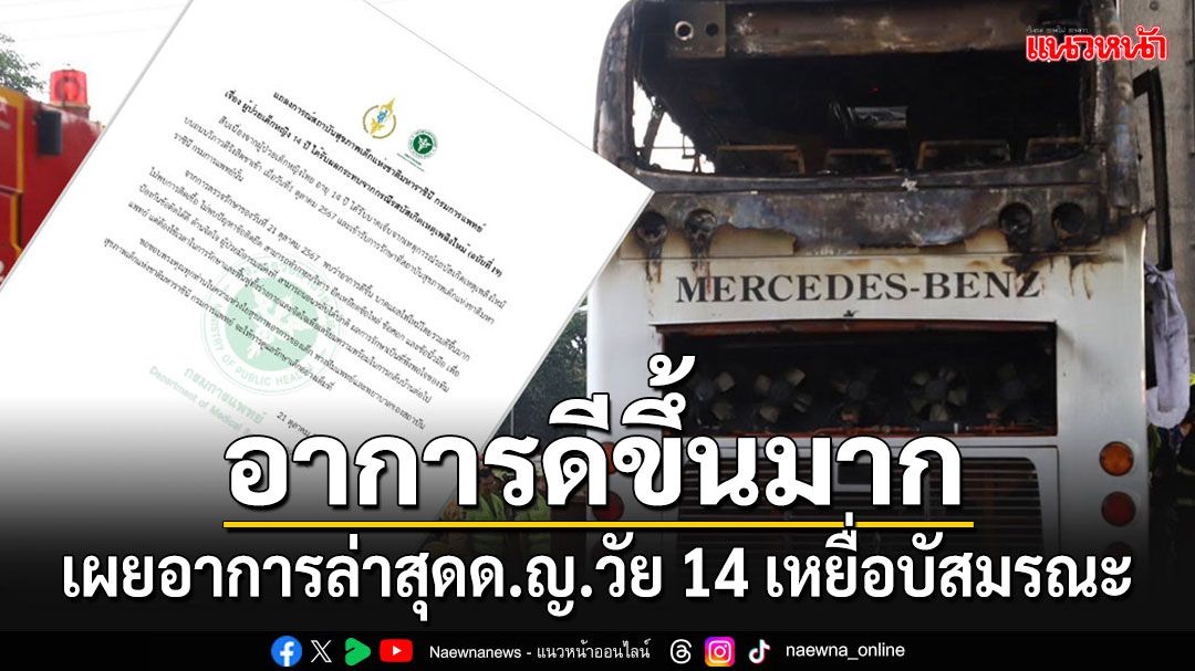 เผยอาการล่าสุดด.ญ.วัย 14 เหยื่อไฟไหม้รถบัส ดีขึ้นมาก-ไม่พบปัญหาข้อติดยึด