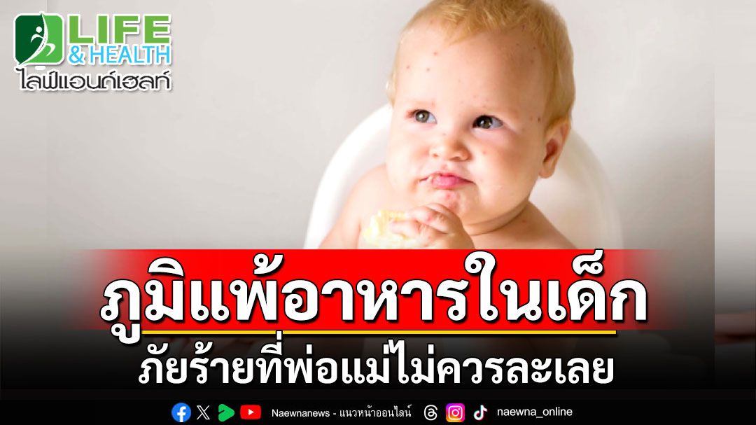 LIFE & HEALTH : ภูมิแพ้อาหารในเด็ก ภัยร้ายที่พ่อแม่ไม่ควรละเลย