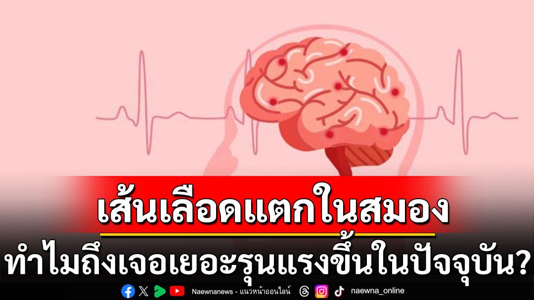 'เส้นเลือดแตกในสมอง' ทำไมถึงเจอเยอะขึ้นและรุนแรงขึ้นในปัจจุบัน?