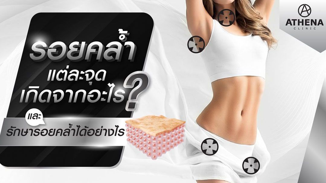 รอยคล้ำในร่างกายแต่ละจุดเกิดจากอะไร?