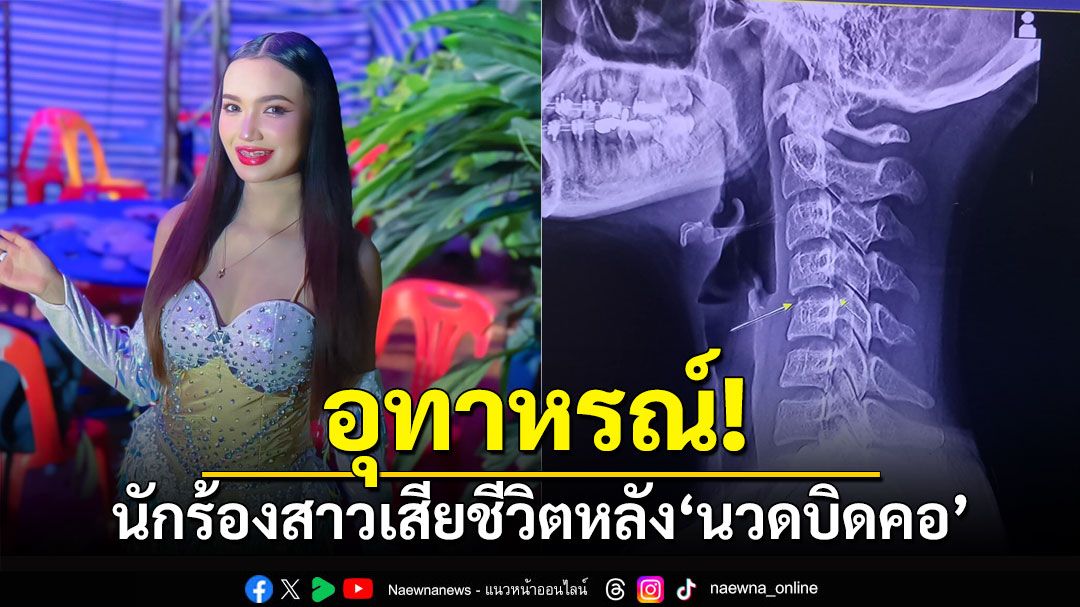 อุทาหรณ์! นักร้องสาวเสียชีวิต จากผลข้างเคียง'นวดบิดคอ'แผนโบราณ