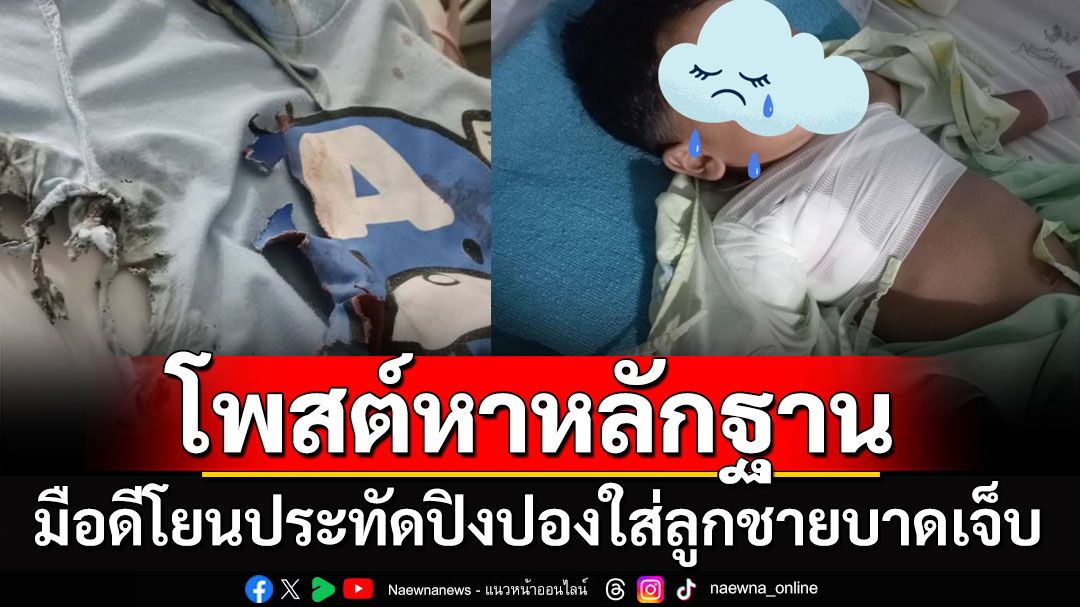 สาวโพสต์หาหลักฐาน มือดีโยนประทัดปิงปองใส่ลูกชายบาดเจ็บ