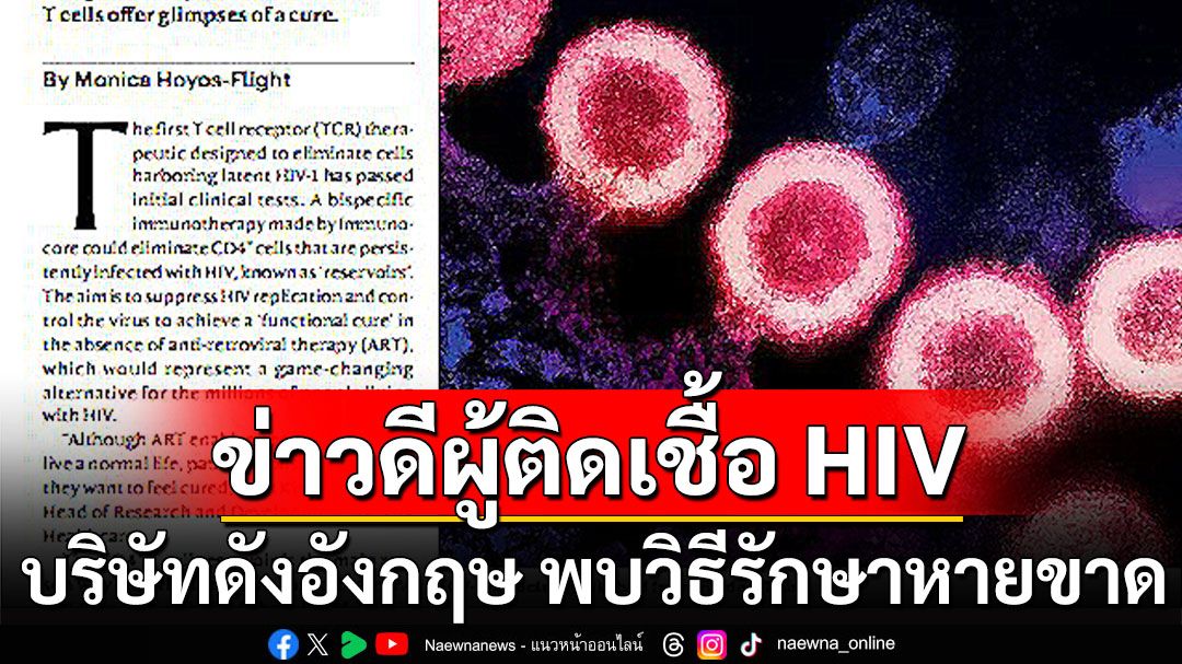 'ดร.อนันต์'เผยข่าวดีสำหรับผู้ติดเชื้อ HIV บริษัทดังในอังกฤษ ค้นพบวิธีรักษาให้หายขาด