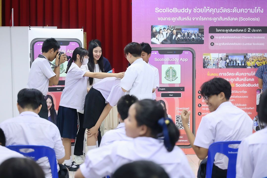 'ปุณศิรา เธียรวร' บุกเบิกแอปฯ ScolioBuddy ตรวจคัดกรองโรคกระดูกสันหลังคด หวังช่วยผู้ป่วยกว่า 1-2 ล้านคนทั่วประเทศ