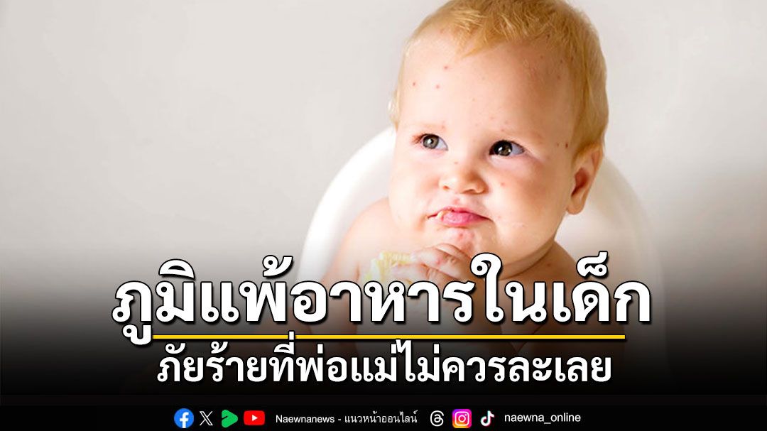 ภูมิแพ้อาหารในเด็ก ภัยร้ายที่พ่อแม่ไม่ควรละเลย