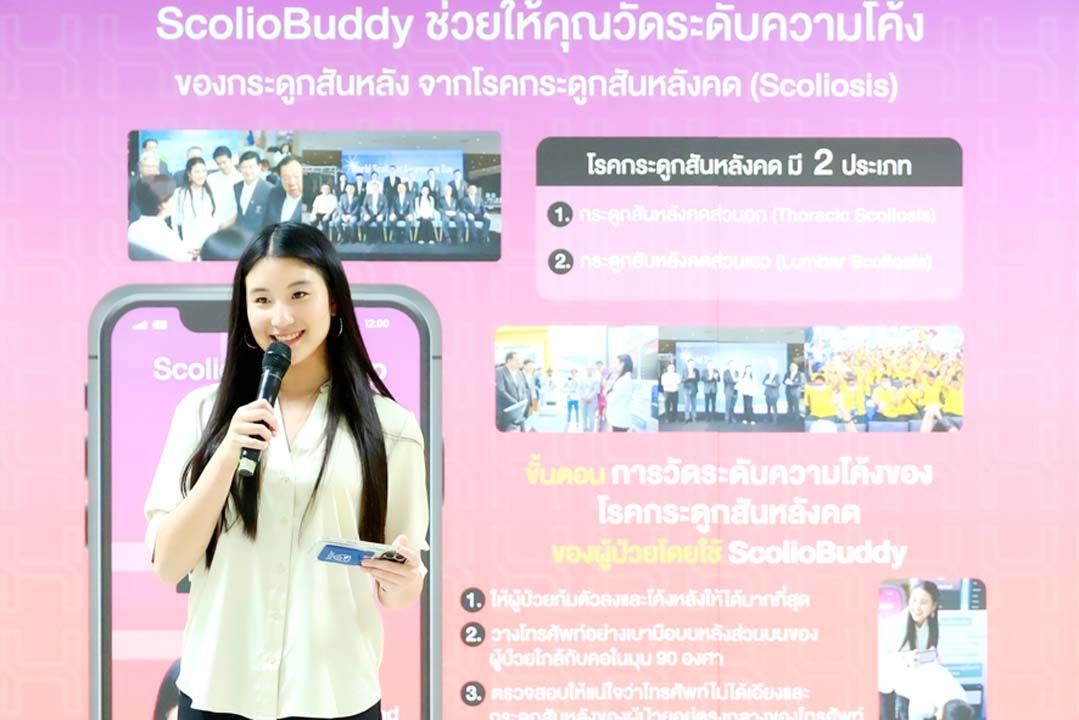 ‘ปุณศิรา เธียรวร’ บุกเบิกแอปฯ ScolioBuddy ตรวจคัดกรองโรคกระดูกสันหลังคด