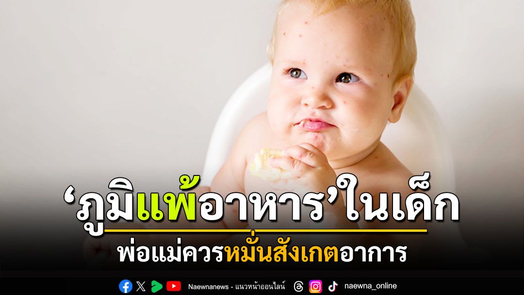 พ่อแม่ควรหมั่นสังเกตอาการ ‘ภูมิแพ้อาหาร’ ในเด็ก