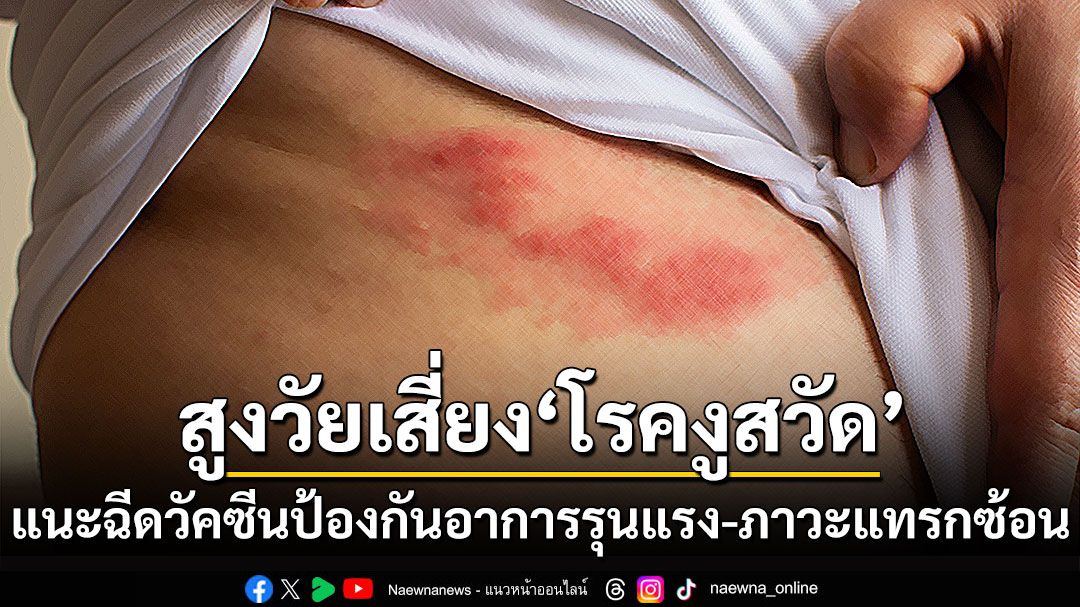 สูงวัยเสี่ยง ‘โรคงูสวัด’ แนะฉีดวัคซีนป้องกันอาการรุนแรง-ภาวะแทรกซ้อน