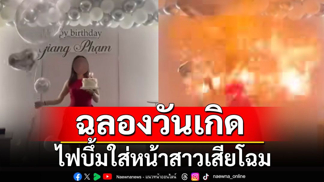 อุทาหรณ์! สาวเวียดนามฉลองวันเกิด ลูกโป่งติดไฟบึ้มใส่หน้าเสียโฉม