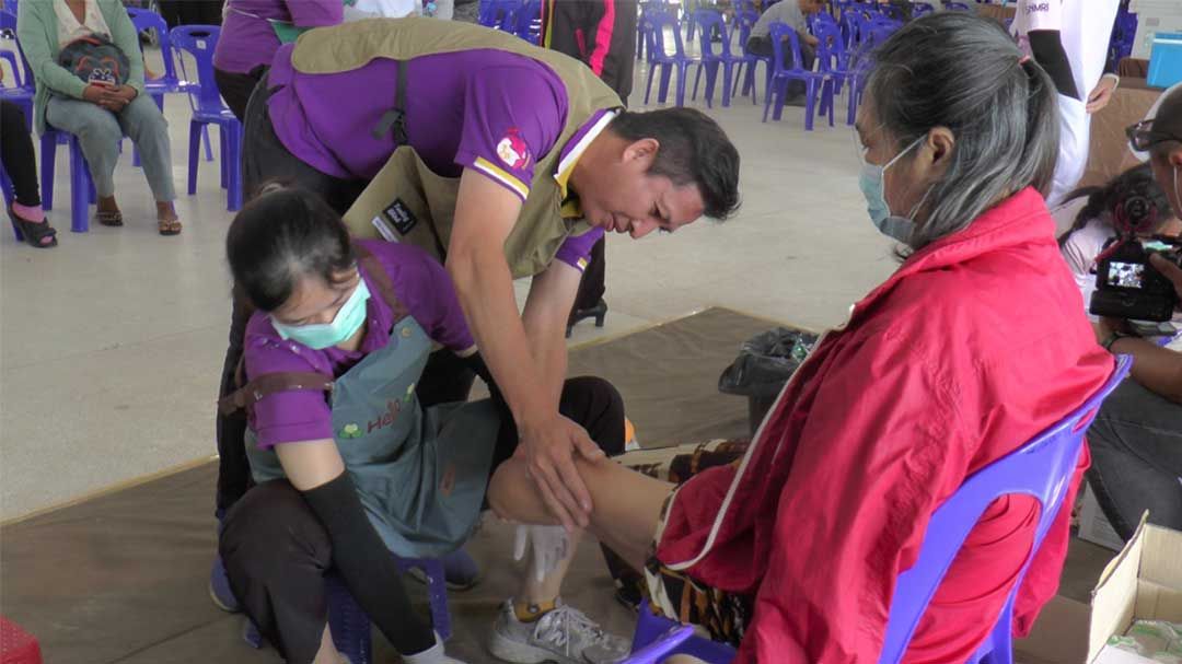 สถาบันสิรินธรฯ ‘จัดทีมแพทย์ผลิตแขน-ขาเทียม’ เพื่อผู้พิการในพื้นที่ห่างไกล