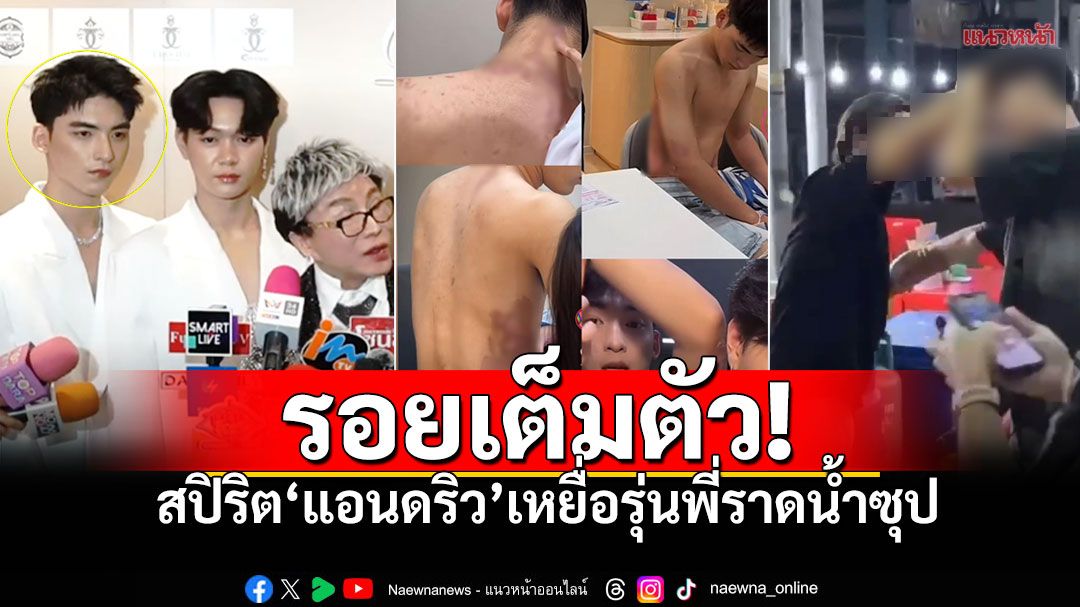 บาดแผลเต็มตัว! 'น้องแอนดริว'ยังใจสู้ ร่วมงานเพชร'ไฮโซชูชัย' เหยื่อรุ่นพี่สาดน้ำซุป