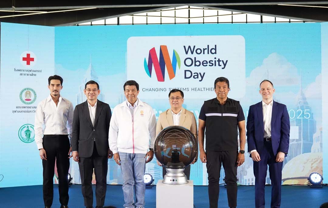 แพทยศาสตร์ จุฬาฯ จับมือพันธมิตร จัดงาน ‘วันอ้วนโลก’  รณรงค์คนไทย ‘อ้วนแล้วเปลี่ยน... เริ่มวันนี้ เพื่อชีวิตที่ยั่งยืน’
