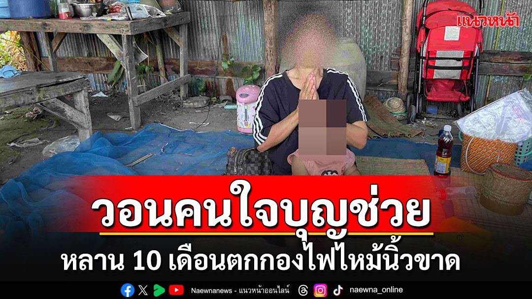 ยายวอนช่วยเหลือหลานวัย 10 เดือน ตกลงไปในกองไฟนิ้วขาด ยากจนไม่มีเงินซื้อนมให้กิน