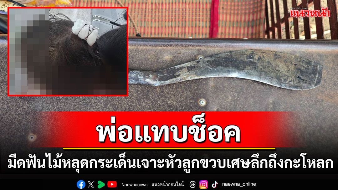 พ่อแทบช็อค! มีดฟันไม้หลุดจากด้ามกระเด็นโดนหัวลูกขวบเศษแผลลึกถึงกะโหลกเย็บ 4 เข็ม