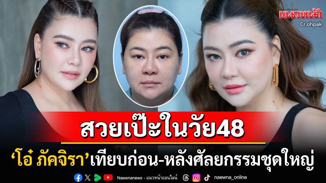 48ปียังสวยปิ๊ง! 'โอ๋ ภัคจิรา'เปิดหน้าสดพลีชีพ เทียบชัดๆก่อน-หลังศัลยกรรมชุดใหญ่