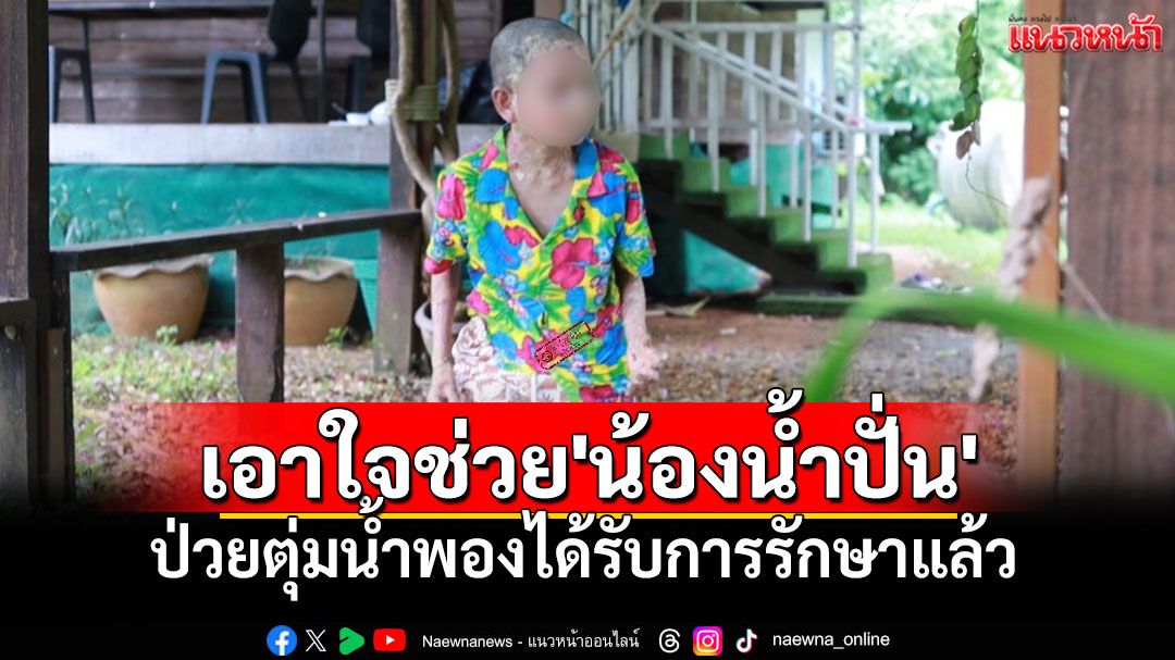 พลังใจล้น! 'น้องน้ำปั่น'ชู 2 นิ้วสู้ตุ่มน้ำพอง คุณยายเคียงข้างให้กำลังใจไม่ห่าง