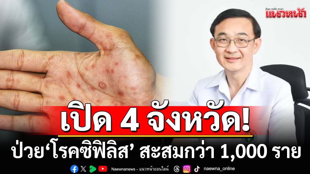 สคร.9 เปิด 4 จังหวัด ยอดผู้ป่วย'โรคซิฟิลิส' สะสมกว่า 1,000 ราย ตั้งแต่ 1 ม.ค.-29 พ.ค.68
