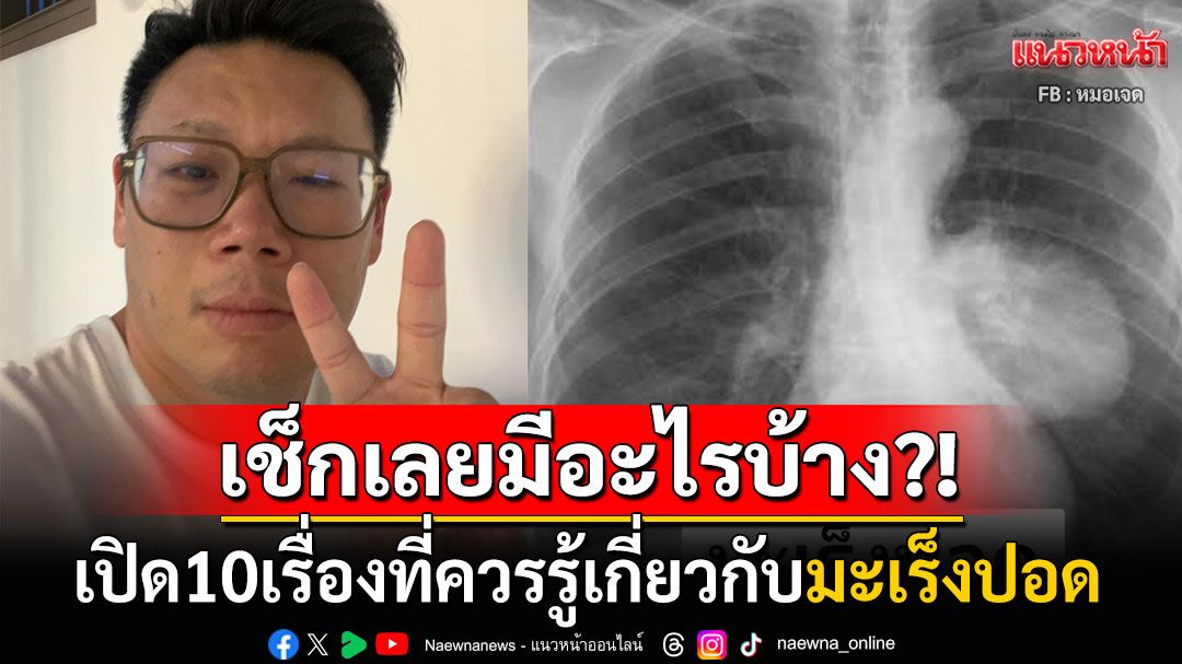 'หมอเจด'เปิด10เรื่องที่ควรรู้เกี่ยวกับมะเร็งปอด พบ5สิ่งในบ้านภัยเงียบเพิ่มความเสี่ยง