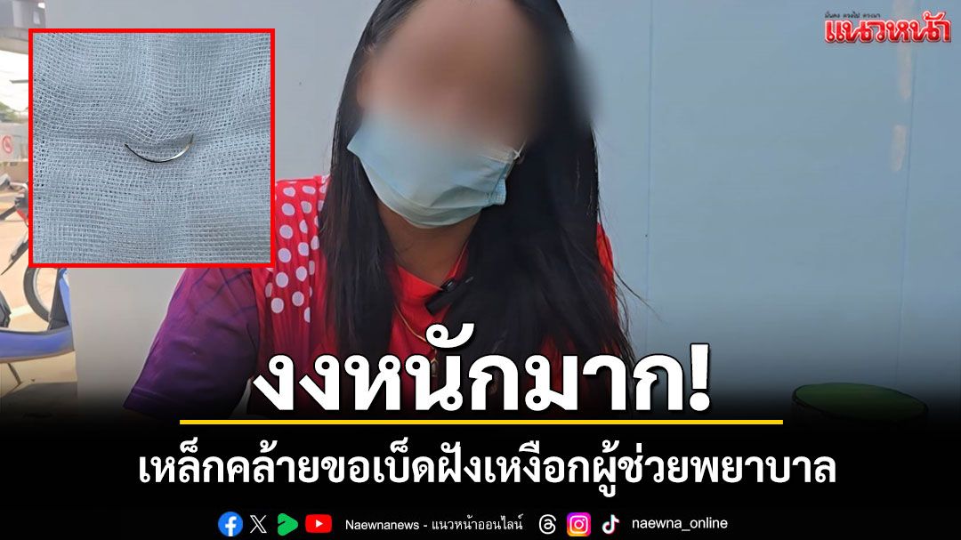 อุทาหรณ์กินขนมจีน! ผู้ช่วยพยาบาลเจ็บคอ หมอผ่าตัดพบเหล็กปริศนา 3 ซม.ฝังเหงือก