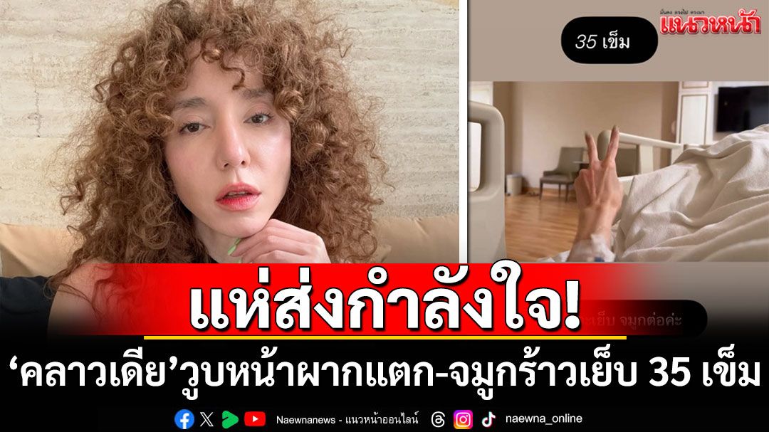 แห่ส่งกำลังใจ! 'คลาวเดีย'วูบหน้าผากแตก-จมูกร้าว เย็บ 35 เข็ม