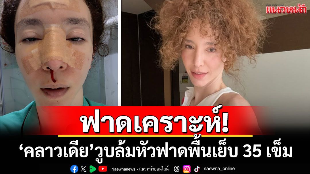 ฟาดเคราะห์! 'คลาวเดีย จักรพันธุ์'วูบล้มหัวฟาดพื้นเย็บ 35 เข็ม
