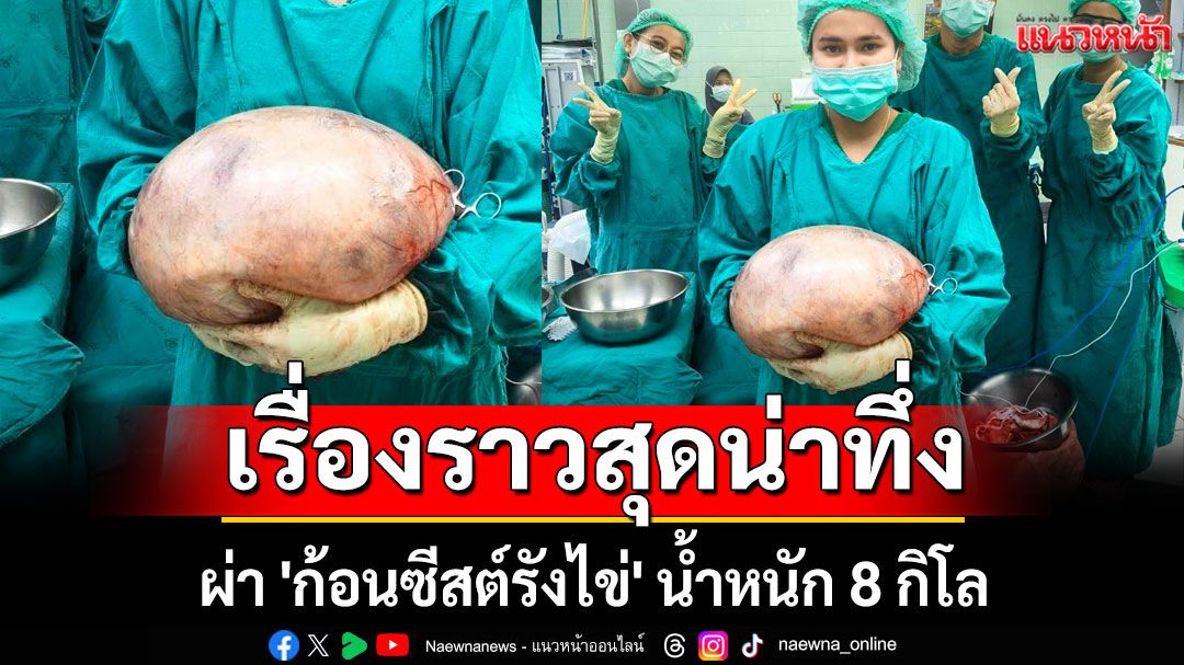 'หมอ'เผย เรื่องราวสุดน่าทึ่ง ผ่า 'ก้อนซีสต์รังไข่' น้ำหนัก 8 กิโล
