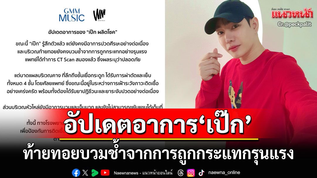 อัปเดตอาการ! 'เป๊ก ผลิตโชค'รู้สึกตัวแล้วแต่ยังปวดศีรษะ งดเยี่ยมหวั่นแผลติดเชื้อ
