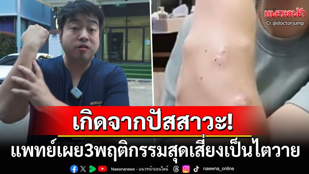 แพทย์เผยพฤติกรรมสุดเสี่ยง! หญิงป่วยโรคไตระยะสุดท้าย เกิดจาก3ปัจจัยเกี่ยวกับ'ปัสสาวะ'