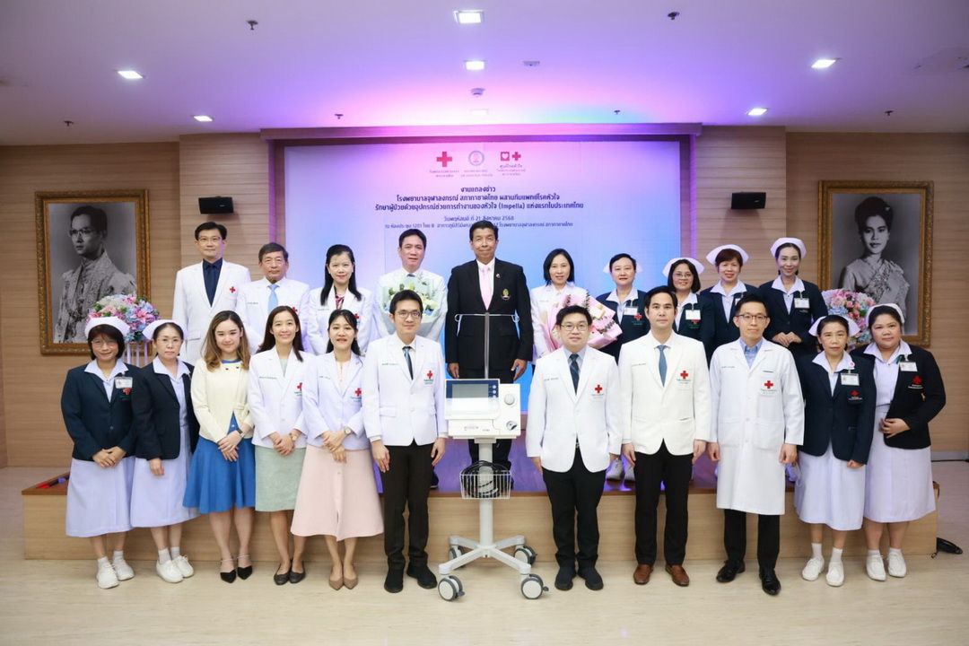 รพ.จุฬาลงกรณ์ฯ ผสานทีมแพทย์โรคหัวใจ รักษาผู้ป่วยด้วยอุปกรณ์ช่วยการทำงานของหัวใจแห่งแรกในไทย