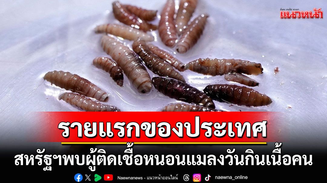 รายแรกของประเทศ! สหรัฐฯพบผู้ติดเชื้อ'หนอนแมลงวันกินเนื้อคน' เพิ่งกลับมาจากเอลซัลวาดอร์