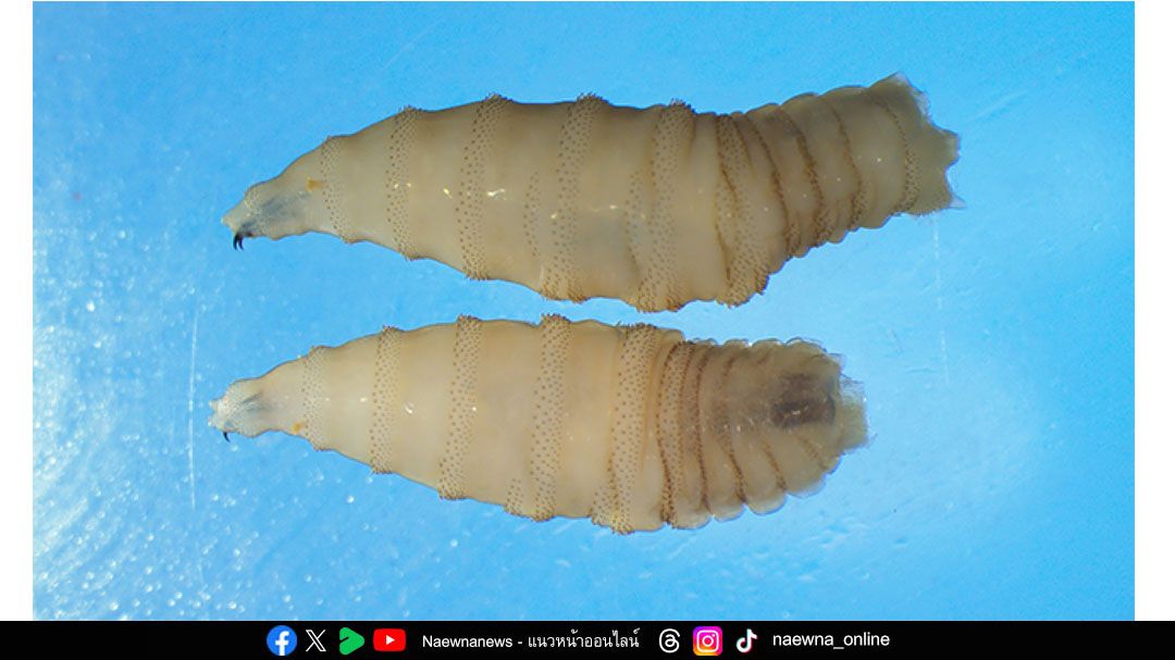 Health News :พบผู้ป่วยหนอนไชกินเนื้อมนุษย์ในสหรัฐฯ