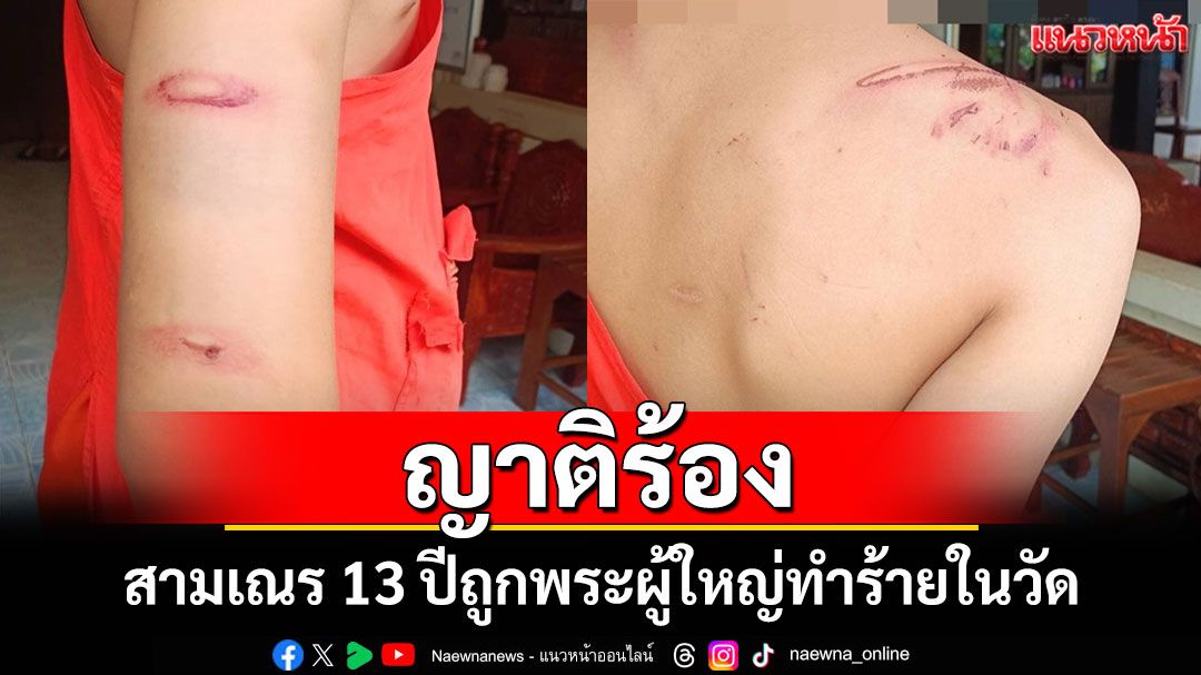 ญาติร้องขอความเป็นธรรม สามเณร 13 ปีถูกพระผู้ใหญ่ใช้ความรุนแรงทำร้ายในวัด