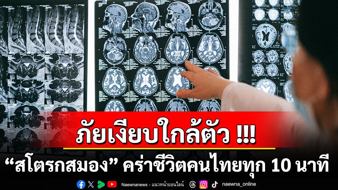 ภัยเงียบใกล้ตัว!!! “สโตรกสมอง” คร่าชีวิตคนไทยทุก 10 นาที  รู้ทัน BEFAST ลดพิการ ลดตาย