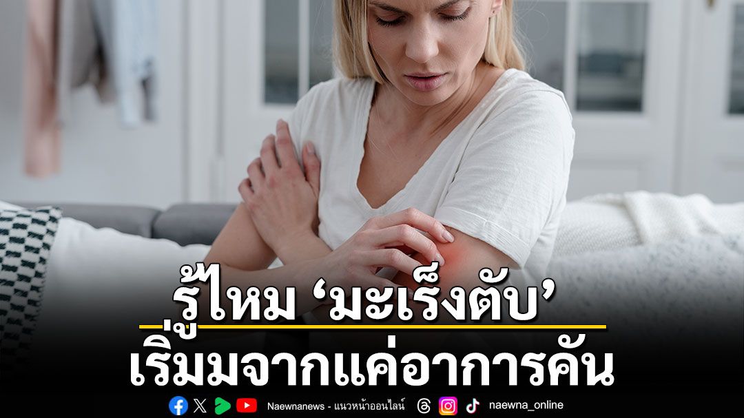 รู้ไหม ‘มะเร็งตับ’ เริ่มมจากแค่อาการคัน