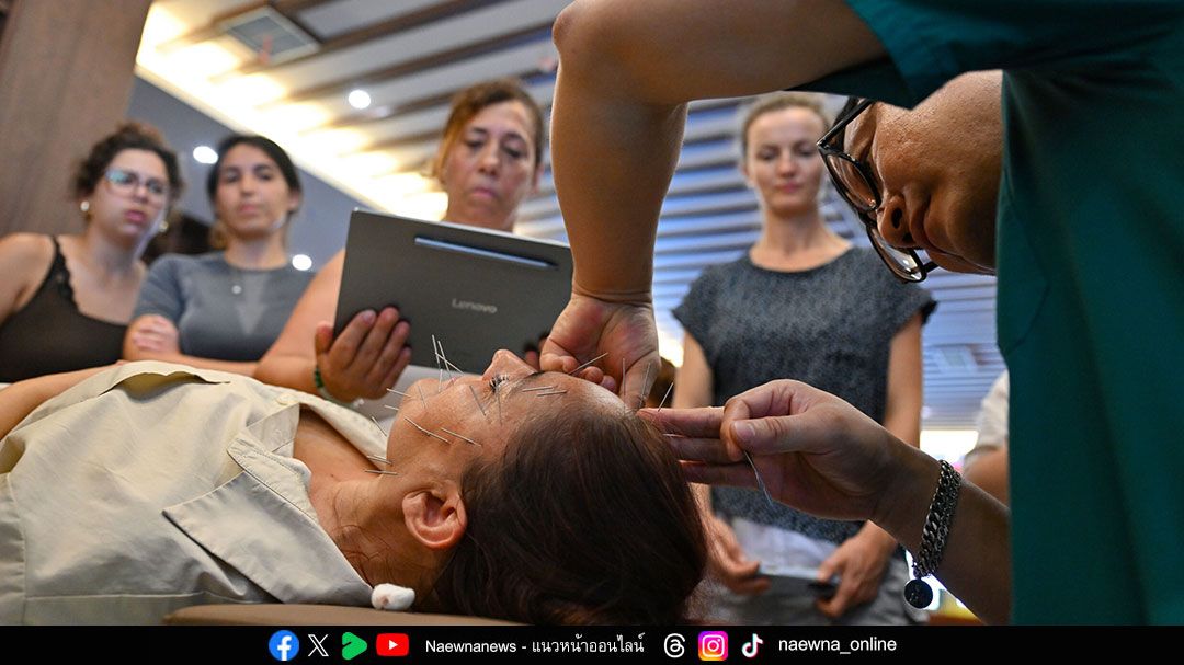 Health News: ฝังเข็ม’ ช่วยลด ‘ปวดหลังส่วนล่างเรื้อรัง’