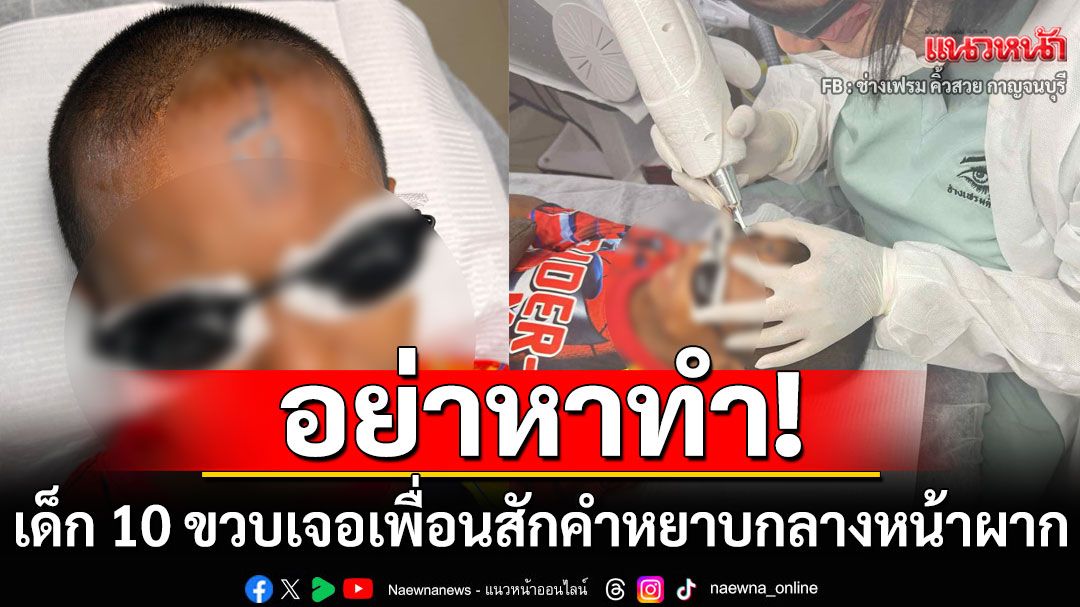พิเรนทร์สุดๆ เด็ก 10 ขวบเจอเพื่อนเล่นแรง สักคำหยาบกลางหน้าผาก
