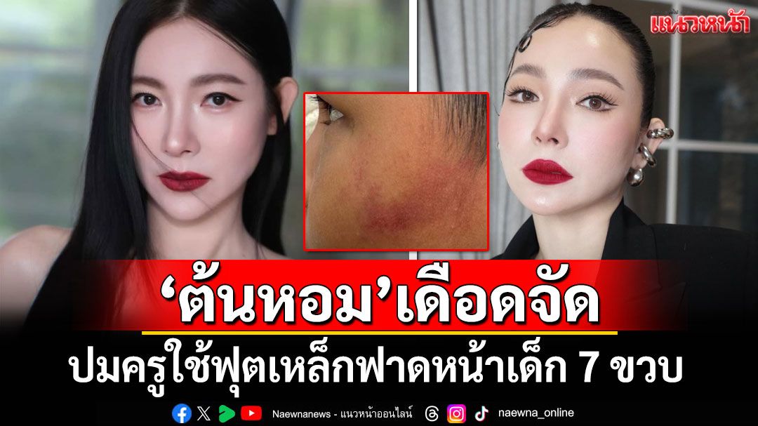 'ดีเจต้นหอม'เดือดจัด! ปมครูใช้ฟุตเหล็กฟาดหน้าเด็ก 7 ขวบ