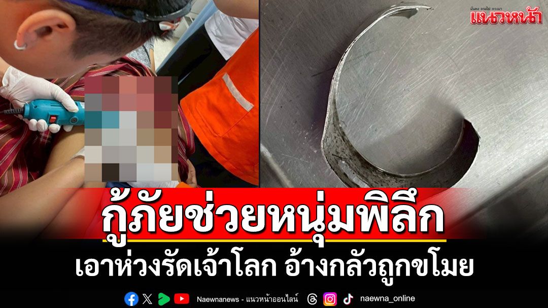หนุ่มพิลึก! กลัวโดนขโมยเจ้าโลกไซส์ 69 เอาห่วงเหล็กล็อคจนบวมเป่ง ต้องแจ้งกู้ภัยช่วยตัด