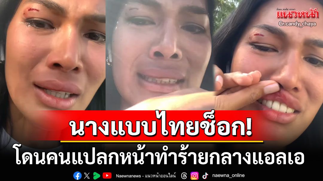 ร้องไห้หนักกลางLA! นางแบบไทยโดนคนแปลกหน้าทำร้าย คิ้ว-ปากถึงกับแตก