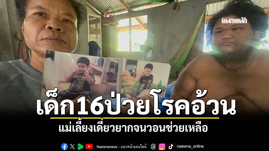 เด็กหนุ่ม16ปีป่วยโรคอ้วนหนัก180 กก. แม่เลี้ยงเดี่ยวยากจน วอนหน่วยงานช่วยเหลือ