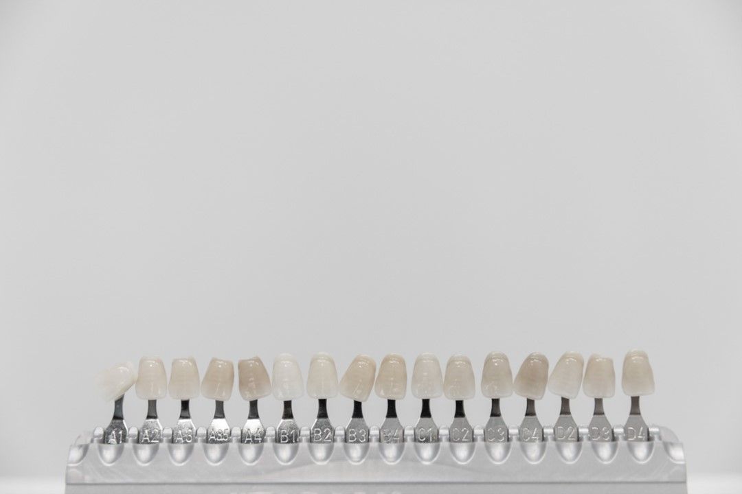 เจาะลึกกระบวนการทำฟันขาวด้วยวีเนียร์และการดูแลหลังทำ !