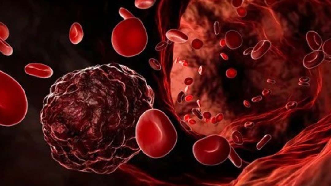 ‘แพทย์แผนจีน’ผสานศาสตร์ตะวันตก เสริมภูมิคุ้มกัน ลดผลข้างเคียงผู้ป่วยมะเร็ง