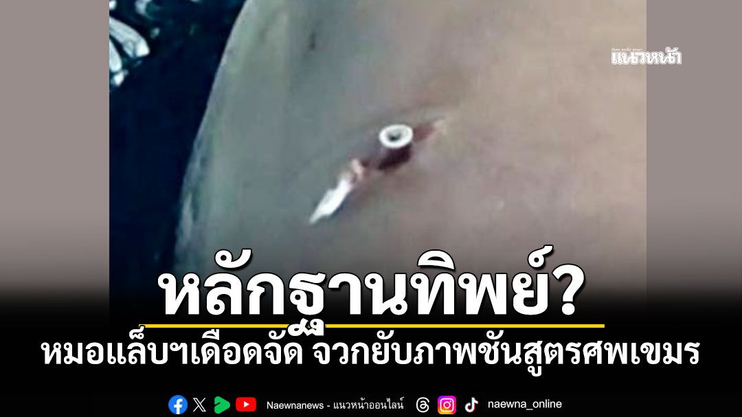 บ้าแล้ว! หมอแล็บฯเดือดจัด จวกยับภาพชันสูตรศพเขมร อ้างว่าถูกยิง