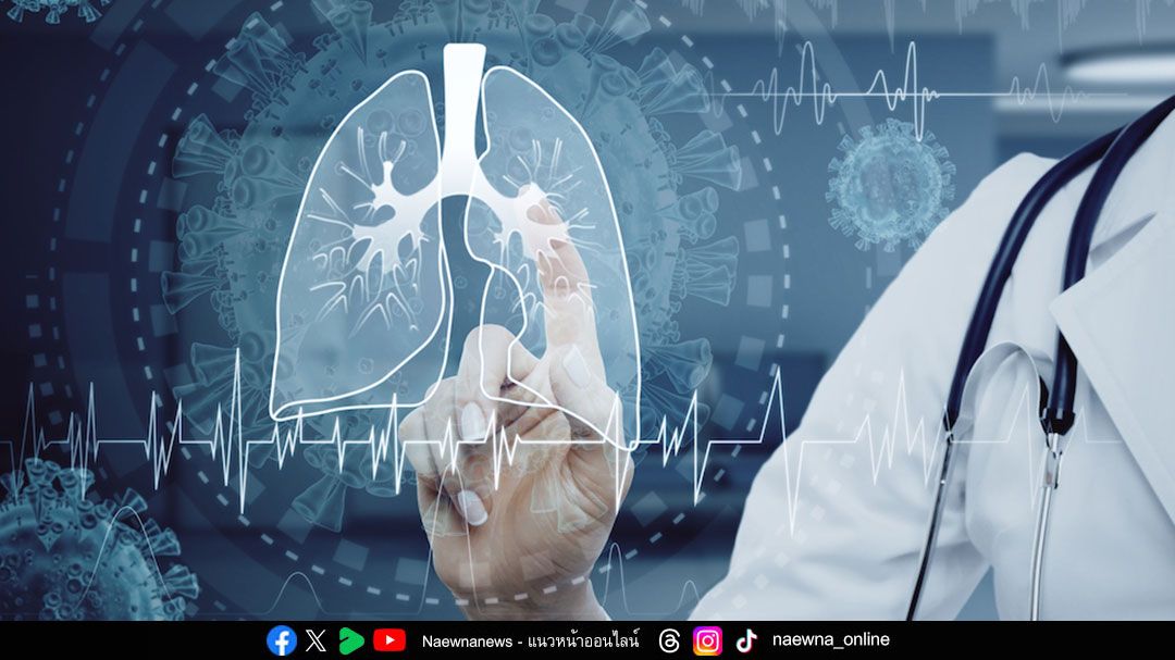 นวัตกรรมตรวจคัดกรองมะเร็งปอดด้วย Low Dose CT Scan