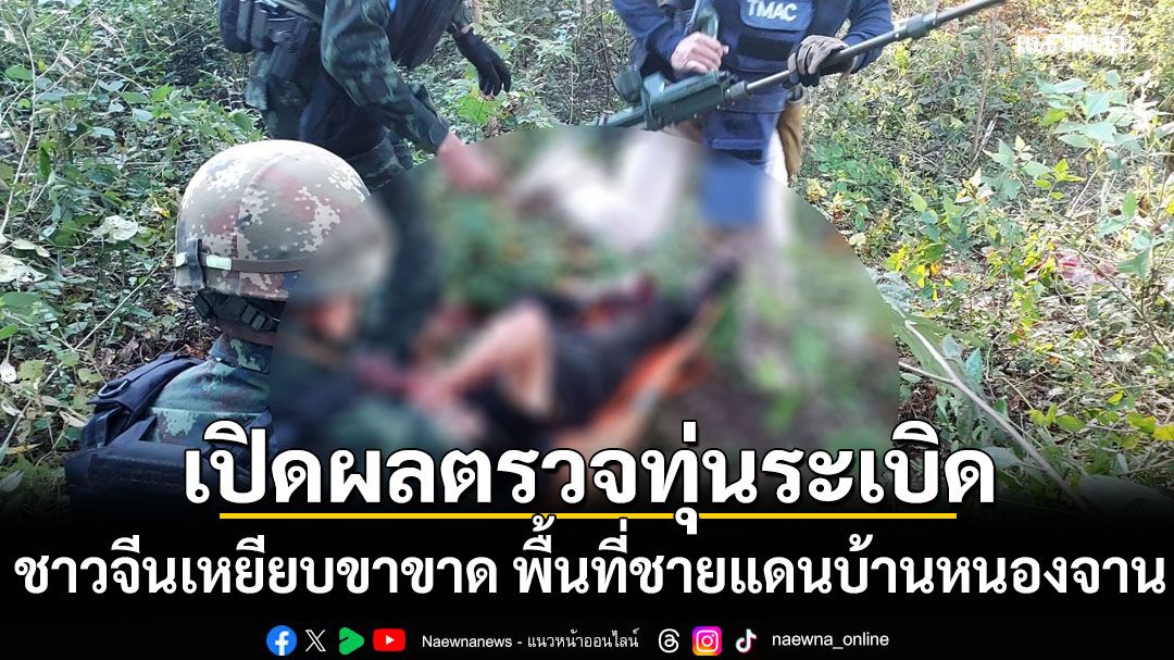 เปิดผลตรวจทุ่นระเบิด ชาวจีนเหยียบขาขาด พื้นที่ชายแดนบ้านหนองจาน